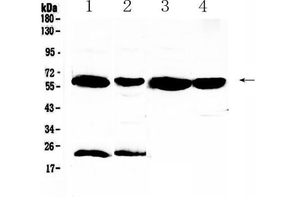 UGT1A1 antibody  (AA 316-533)