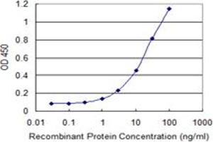 Detection limit for recombinant GST tagged ZNF263 is 0. (ZNF263 antibody  (AA 1-683))