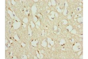 Immunohistochemistry of paraffin-embedded human brain tissue using ABIN7176144 at dilution of 1:100 (ZNF195 antibody  (AA 1-250))