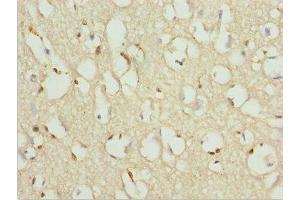 Immunohistochemistry of paraffin-embedded human brain tissue using ABIN7176144 at dilution of 1:100