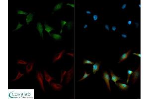 Image no. 4 for anti-Teratocarcinoma-Derived Growth Factor 1 (TDGF1) (N-Term) antibody (ABIN363493) (TDGF1 antibody  (N-Term))