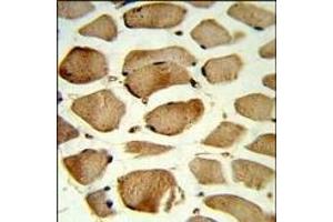 Immunohistochemistry (Paraffin-embedded Sections) (IHC (p)) image for anti-Caveolin 2 (CAV2) (AA 11-44), (N-Term) antibody (ABIN652586)