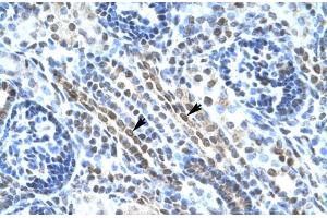 Human kidney (ANKRD11 antibody  (N-Term))