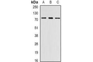 Western blot analysis of PRDM6 expression in Jurkat (A), MCF7 (B), mouse lung (C) whole cell lysates. (PRDM6 antibody)