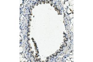 IHC analysis of NHEJ1 using anti-NHEJ1 antibody (ABIN7599198). (NHEJ1 antibody  (AA 1-273))
