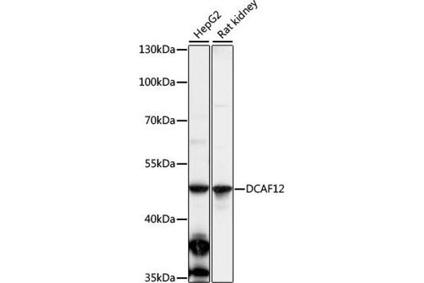 DCAF12 antibody  (AA 1-85)