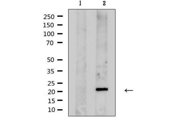 KCNMB1 antibody