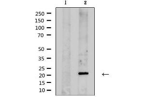 Western blot analysis of extracts from rat brain , using KCNMB1 Antibody. (KCNMB1 antibody)
