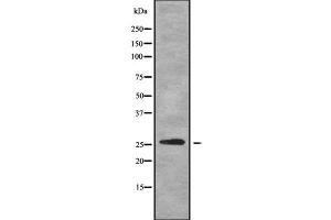 Western blot analysis SFRS9 using HepG2 whole cell lysates (SFRS9 antibody  (Internal Region))