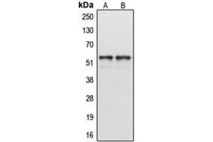 Western blot analysis of Cytochrome P450 1A1/2 expression in MCF7 (A), HeLa (B) whole cell lysates.