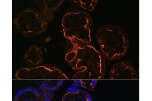 Immunofluorescence analysis of Human placenta cells using LDB3 Polyclonal Antibody at dilution of 1:100. (LIM Domain Binding 3 Protein antibody)