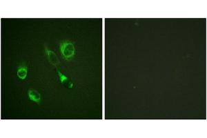 Immunofluorescence staining of methanol-fixed HeLa cells using EPHA2/3/4 (Phospho-Tyr588/596) Antibody. (EPH Receptor A2 antibody  (pTyr588, pTyr596))