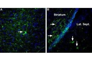 Expression of Neurexin 3α in rat and mouse brain - Immunohistochemical staining of rat entorhinal cortex (A) and mouse striatum and lateral septum (B) using Anti-Neurexin 3α (extracellular) Antibody (ABIN7043359, ABIN7044678 and ABIN7044679), (1:400). (Neurexin 3 antibody  (Extracellular, N-Term))