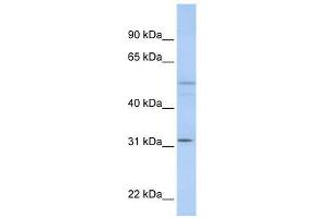 ZFYVE19 antibody used at 0.