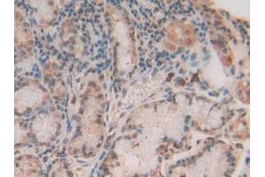 IHC-P analysis of Human Stomach Tissue, with DAB staining. (S100A11 antibody  (AA 1-105))