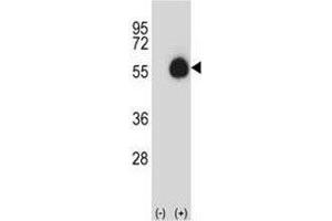 Western blot analysis of CD33 antibody and 293 cell lysate (2 ug/lane) either nontransfected (Lane 1) or transiently transfected (2) with the CD33 gene. (CD33 antibody  (AA 88-117))