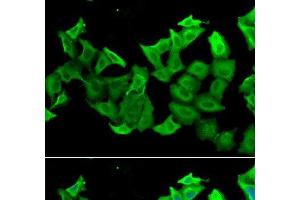 Immunofluorescence analysis of A549 cells using HAGH Polyclonal Antibody (HAGH antibody)