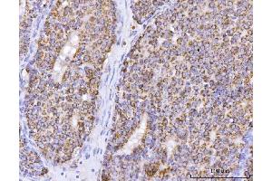 IHC analysis of ATP5F1B using anti-ATP5F1B antibody (ABIN7599866). (Atp5f1b (AA 123-529) antibody)