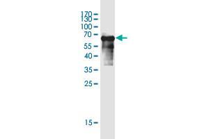 Western Blot detection against Immunogen (65. (SERTAD4 antibody  (AA 1-356))