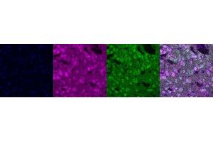 Immunohistochemistry (IHC) image for anti-Protein Phosphatase 1, Regulatory (Inhibitor) Subunit 1B (PPP1R1B) antibody (ABIN7456071) (DARPP32 antibody)