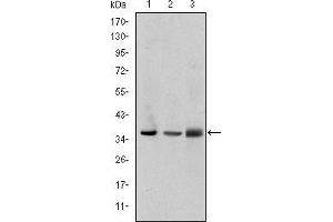 LIMS1 antibody