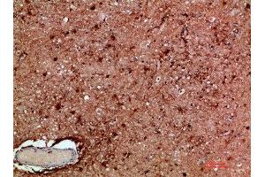 Immunohistochemistry (IHC) image for anti-Inhibitor of kappa Light Polypeptide Gene Enhancer in B-Cells, Kinase gamma (IKBKG) (AA 60-120) antibody (ABIN7189515)