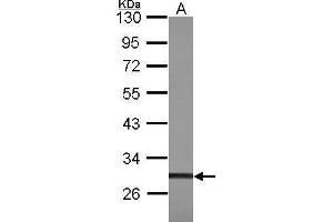 WB Image Sample (30 ug of whole cell lysate) A: 293T 10% SDS PAGE butyrate response factor 1 antibody antibody diluted at 1:1000 (ZFP36L1 antibody  (Center))