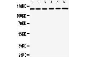 Western Blotting (WB) image for anti-Coxsackie Virus and Adenovirus Receptor (CXADR) (AA 313-328), (C-Term) antibody (ABIN3044083) (Coxsackie Adenovirus Receptor antibody  (C-Term))
