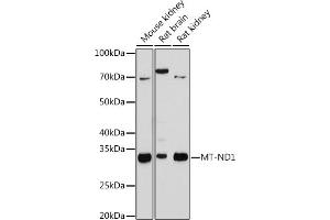 Western blot analysis of extracts of various cell lines, using MT-ND1 antibody (ABIN7268597) at 1:1000 dilution. (MT-ND1 antibody)