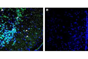 Expression of OPRK1 in rat piriform cortex.