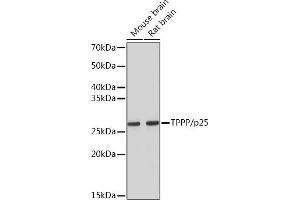 Western blot analysis of extracts of various cell lines, using TPPP/p25 Rabbit mAb (ABIN7271031) at 1:5000 dilution. (Tppp antibody)
