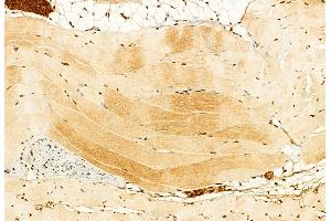 ABIN6259723 and ABIN6279112 at 1/100 staining Mouse skin tissue by IHC-P.