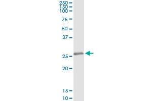 Immunoprecipitation of KCNIP3 transfected lysate using anti-KCNIP3 monoclonal antibody and Protein A Magnetic Bead , and immunoblotted with KCNIP3 MaxPab rabbit polyclonal antibody. (DREAM antibody  (AA 1-256))