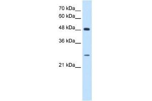 SH3BGR antibody used at 0. (SH3BGR antibody  (N-Term))