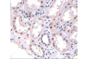 IHC-P analysis of Human Tissue, with DAB staining. (p300 antibody  (AA 1351-1601))