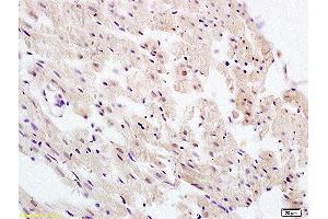 Formalin-fixed and paraffin embedded rat heart labeled with Anti-UBL7 Polyclonal Antibody, Unconjugated  at 1:100 followed by conjugation to the secondary antibody and DAB staining (UBL7 antibody  (AA 51-150))