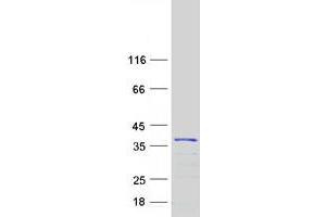 Validation with Western Blot (KCNIP4 Protein (Transcript Variant 6) (Myc-DYKDDDDK Tag))