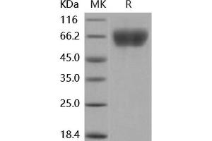 Western Blotting (WB) image for Fibroblast Growth Factor Receptor 3 (FGFR3) (Active) protein (His tag) (ABIN7320453) (FGFR3 Protein (His tag))