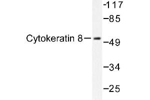 Image no. 1 for anti-Keratin 8 (KRT8) antibody (ABIN272030) (KRT8 antibody)
