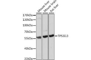 Western blot analysis of extracts of various cell lines, using TP53I13 antibody (ABIN7271098) at 1:1000 dilution. (TP53I13 antibody  (AA 180-310))