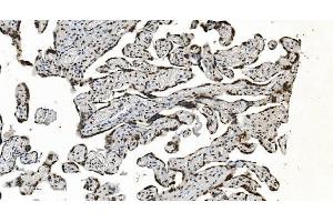 IHC analysis of HNRNPH3 using anti-HNRNPH3 antibody (ABIN7601121). (HNRNPH3 antibody  (AA 29-268))
