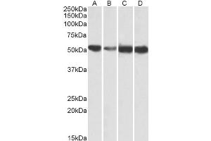 Western Blotting (WB) image for anti-ATP Synthase, H+ Transporting, Mitochondrial F1 Complex, alpha Subunit 1, Cardiac Muscle (ATP5A1) antibody (ABIN5910982) (ATP5A1 antibody)