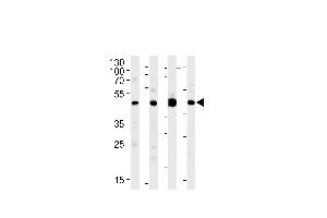 MEK1 Antibody (M1) (ABIN1882177 and ABIN2842020) western blot analysis in Jurkat,PC-12,rat C6 cell line and mouse brain lysates (35 μg/lane). (MEK1 antibody  (N-Term))