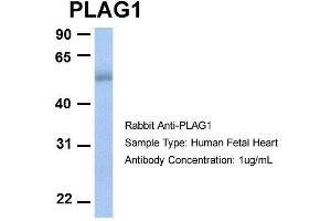 Host:  Rabbit  Target Name:  PLAG1  Sample Type:  Human Fetal Heart  Antibody Dilution:  1. (PLAG1 antibody  (N-Term))