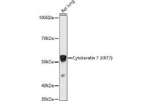 Western blot analysis of extracts of Rat lung, using Cytokeratin 7 (KRT7) antibody (ABIN6129292, ABIN6143037, ABIN6143039 and ABIN6215559) at 1:1000 dilution.