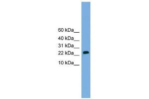 CSH2 antibody used at 1 ug/ml to detect target protein. (CSH1 antibody  (Middle Region))