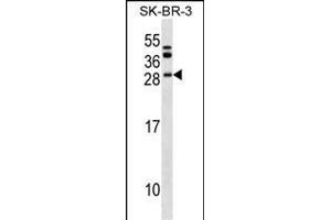 BCL7C Antibody (N-term) (ABIN1539556 and ABIN2849559) western blot analysis in SK-BR-3 cell line lysates (35 μg/lane). (BCL7C antibody  (N-Term))
