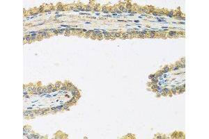 Immunohistochemistry of paraffin-embedded Human prostate using CRHBP Polyclonal Antibody at dilution of 1:100 (40x lens). (CRHBP antibody)