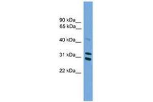 Image no. 1 for anti-Proteasome (Prosome, Macropain) Activator Subunit 2 (PA28 Beta) (PSME2) (C-Term) antibody (ABIN6745118) (PSME2 antibody  (C-Term))