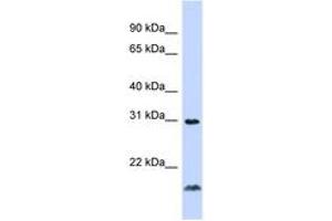 Image no. 1 for anti-Tumor Necrosis Factor (Ligand) Superfamily, Member 14 (TNFSF14) (C-Term) antibody (ABIN6744345) (TNFSF14 antibody  (C-Term))